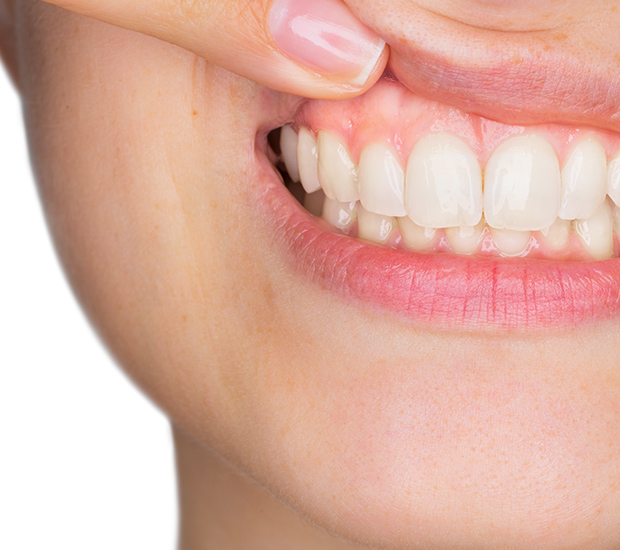 Pittsburg Gum Disease