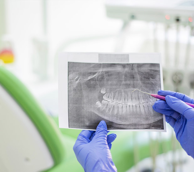 Pittsburg Periodontal Probing