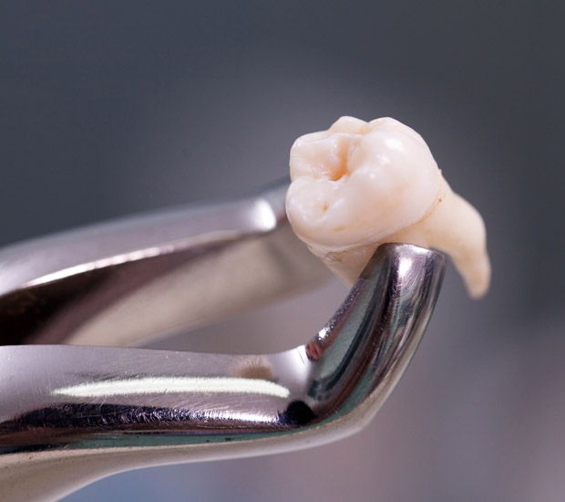 Pittsburg Wisdom Teeth Extraction